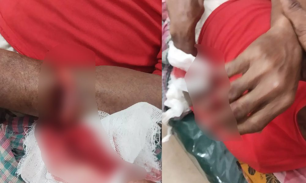 সিংগাইরে জমি বিরোধে ছ্যানদার কোপে কব্জী কর্তন, আহত ২