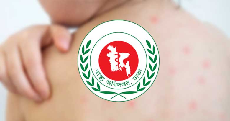 ২৪ ঘণ্টায় হাম উপসর্গে ৫ শিশুর মৃত্যু, আক্রান্ত ১ হাজার ৩৪২